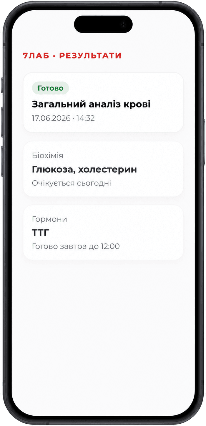 Результати аналізів 7ЛАБ на смартфоні